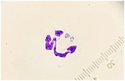 Case report: Disseminated Cladophialophora bantiana phaeohyphomycosis in a dog with hepatic dysfunction, and concurrent ehrlichiosis
